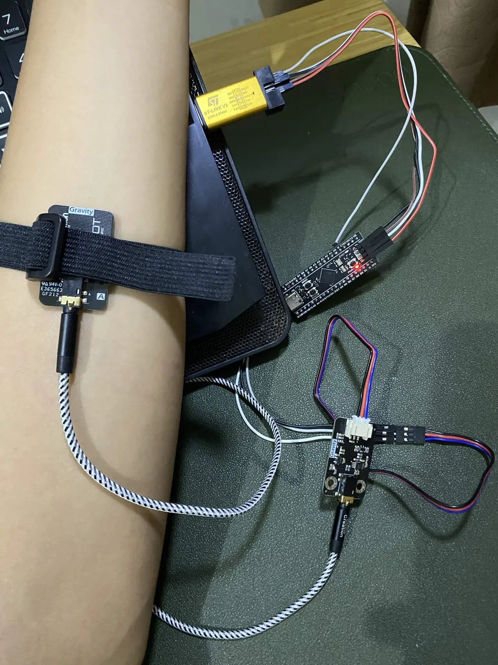 SEN0240 EMG electrode band on a forearm, wired to the acquisition board