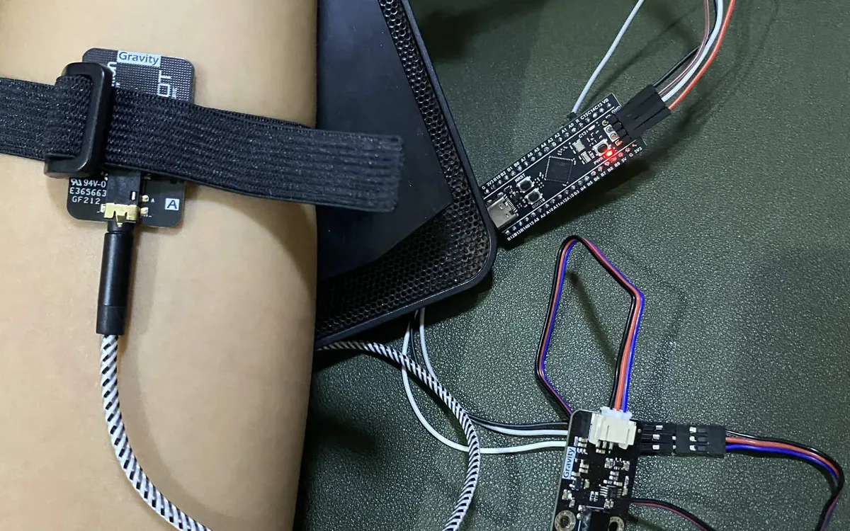 STM32 and SEN0240 EMG acquisition setup