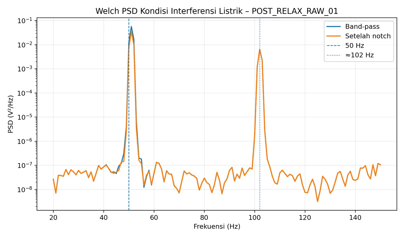 Welch PSD showing 50 Hz mains interference before filtering